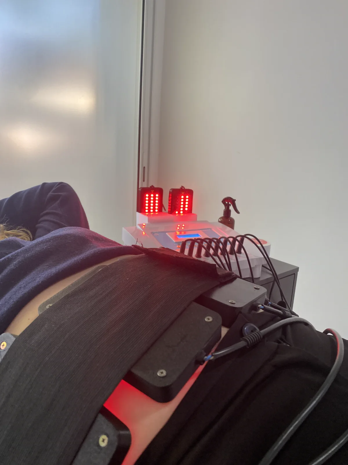 Sesión de Lipoláser en Antoá: los aplicadores con luz láser roja trabajan sobre el abdomen de la clienta junto a la consola del equipo