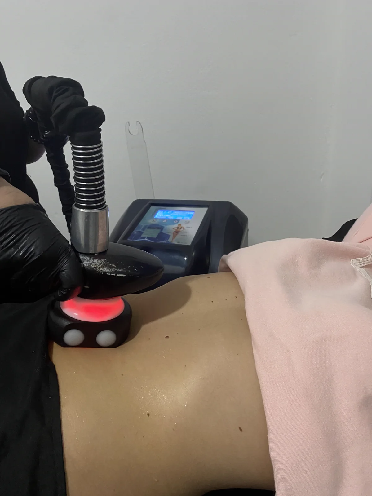 Sesión de Velvet Max en Antoá: el cabezal con rodillos y luz infrarroja se desliza sobre el abdomen de la clienta, junto a la consola del equipo